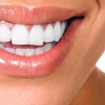 Teeth whitening London Dental Plan